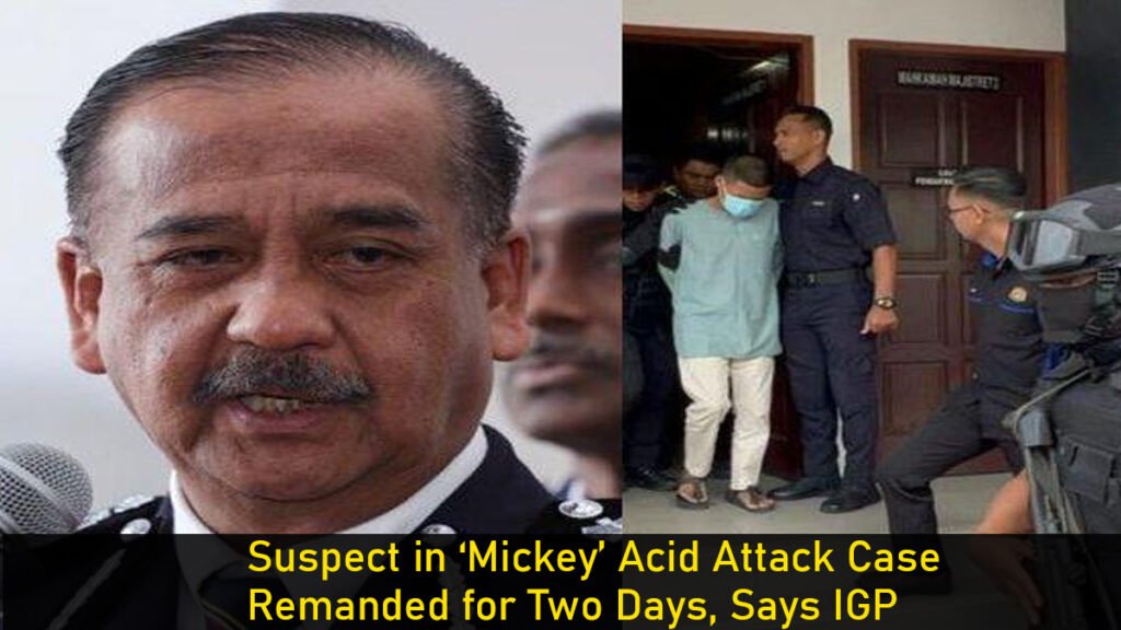 Suspect in ‘Mickey’ Acid Attack Case