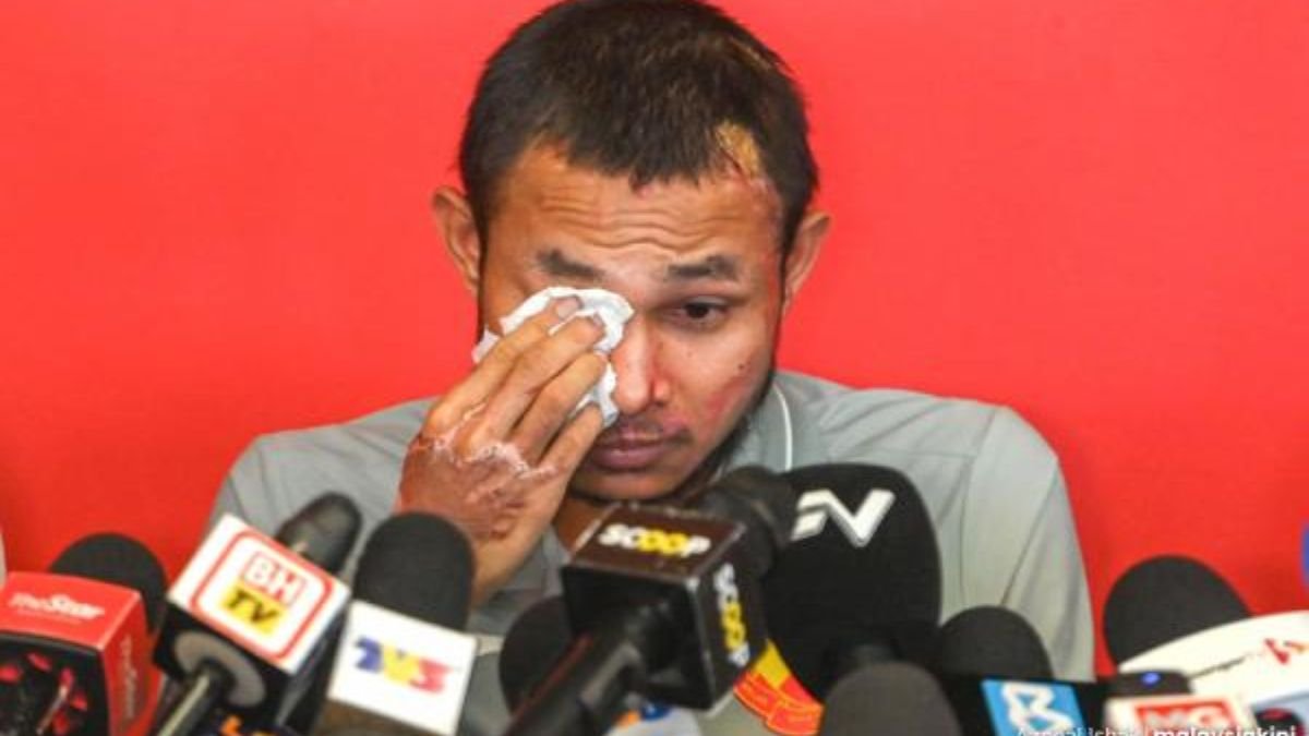 Acid Attack On Selangor FC Footballer: Will Faisal Halim Get Justice?